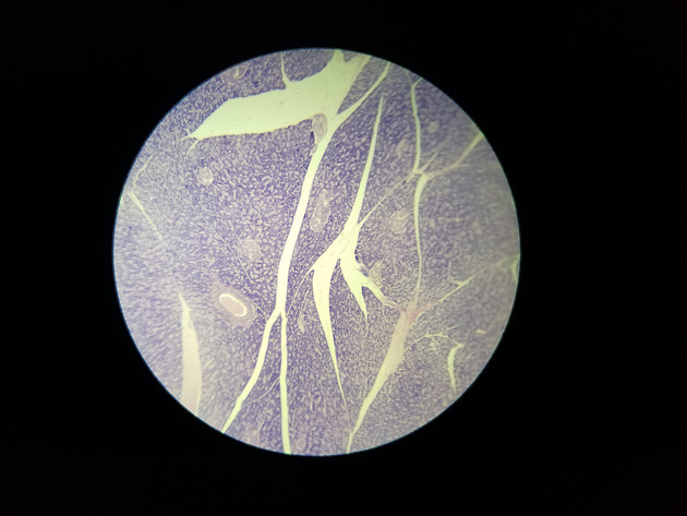 Pancreas Slides - Pancreas 004 40X